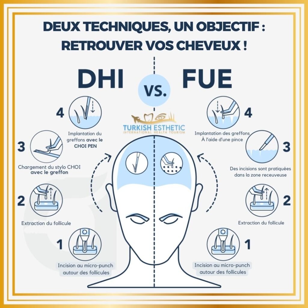 Infographie comparant les techniques DHI et FUE pour la greffe capillaire, avec des étapes détaillées pour chaque méthode, par Turkish Esthetic.