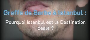 Lire la suite à propos de l’article Greffe de Barbe à Istanbul : Tout savoir en 2025 !